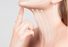 Neck Lift