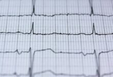 momentum growth analysis report
